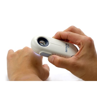 DermLite DL100